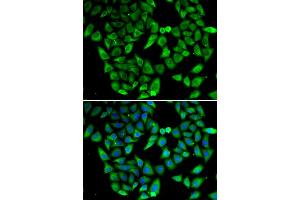 Immunofluorescence analysis of HeLa cells using ASIP antibody.