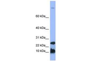 Image no. 1 for anti-Hepcidin Antimicrobial Peptide (HAMP) (N-Term) antibody (ABIN6741742)