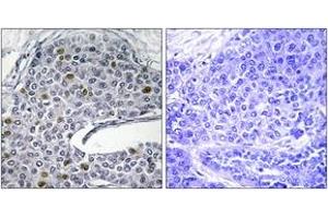 Immunohistochemistry (IHC) image for anti-Interferon Regulatory Factor 3 (IRF3) (AA 351-400) antibody (ABIN2888668) (IRF3 抗体  (AA 351-400))