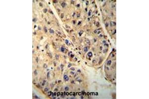 Immunohistochemistry (Paraffin-embedded Sections) (IHC (p)) image for anti-ATP-Binding Cassette, Sub-Family D (Ald), Member 1 (ABCD1) (AA 264-293), (Middle Region) antibody (ABIN950202)