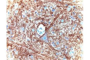 Immunohistochemical staining for Munc-18 on a formalin-fixed, paraffin-embedded rat brain section with citrate buffer pretreatment (40X magnification). (STXBP1 抗体  (AA 18-1))