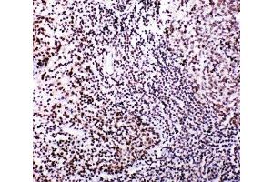 IHC-P: MYBL2 antibody testing of human tonsil tissue (MYBL2 抗体  (N-Term))