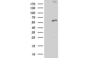 HEK293T cells were transfected with the pCMV6-ENTRY control (Left lane) or pCMV6-ENTRY PSMD3 (Right lane) cDNA for 48 hrs and lysed. (PSMD3 抗体)