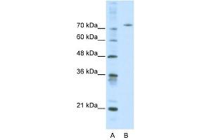 Afamin antibody used at 0.