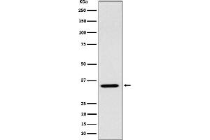 Western Blotting (WB) image for anti-Actin Related Protein 2/3 Complex, Subunit 2, 34kDa (ARPC2) antibody (ABIN7606824)