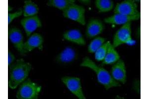 Detection of CAP3 in Human Hela Cell using Polyclonal Antibody to Cytoplasmic Antiproteinase 3 (CAP3) (SERPINB9 抗体  (AA 1-376))