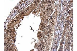 Immunohistochemistry (IHC) image for anti-Cyclin-Dependent Kinase 6 (CDK6) antibody (ABIN2855743)