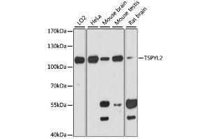 Western blot analysis of extracts of various cell lines, using TSPYL2 antibody (ABIN6291999) at 1:3000 dilution. (TSPY-Like 2 抗体)