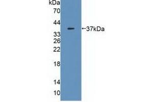 Detection of Recombinant MDH2, Human using Polyclonal Antibody to Malate Dehydrogenase 2 (MDH2) (MDH2 抗体  (AA 25-338))