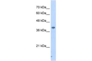Western Blotting (WB) image for anti-Interaction Protein For Cytohesin Exchange Factors 1 (IPCEF1) antibody (ABIN2462961) (ICEF1 抗体)