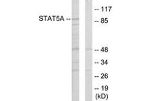 Western Blotting (WB) image for anti-Signal Transducer and Activator of Transcription 5A (STAT5A) (AA 386-435) antibody (ABIN2889477) (STAT5A 抗体  (AA 386-435))