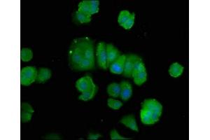 Immunofluorescence staining of MCF-7 cells with ABIN7150235 at 1:100, counter-stained with DAPI.