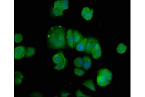 Immunofluorescence staining of MCF-7 cells with ABIN7150235 at 1:100, counter-stained with DAPI. (POLD3 抗体  (AA 203-275))