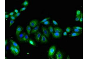 Immunofluorescent analysis of HepG2 cells using ABIN7163948 at dilution of 1:100 and Alexa Fluor 488-congugated AffiniPure Goat Anti-Rabbit IgG(H+L) (KCNA1 抗体  (AA 7-150))