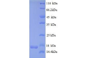 SDS-PAGE (SDS) image for CDKN2A Interacting Protein N-Terminal Like (CDKN2AIPNL) (AA 1-116), (full length) protein (His tag) (ABIN5709267) (CDKN2AIPNL Protein (AA 1-116, full length) (His tag))