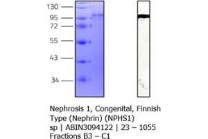 Western Blotting (WB) image for Nephrosis 1, Congenital, Finnish Type (Nephrin) (NPHS1) (AA 23-1055) protein (His tag) (ABIN3094122) (Nephrin Protein (AA 23-1055) (His tag))