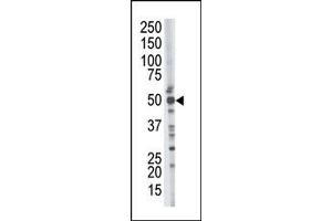 Image no. 1 for anti-Tumor Susceptibility Gene 101 (TSG101) (N-Term) antibody (ABIN357572) (TSG101 抗体  (N-Term))
