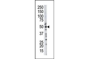 Image no. 1 for anti-Tumor Susceptibility Gene 101 (TSG101) (N-Term) antibody (ABIN357572)