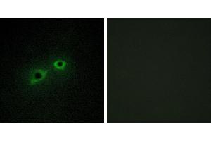 Peptide - +Immunohistochemistry analysis of paraffin-embedded human breast carcinoma tissue, using ENTK antibody. (TMPRSS15 抗体)