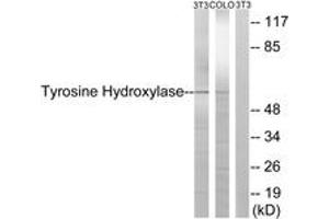 Western blot analysis of extracts from NIH-3T3/COLO cells, treated with Forskolin 40nM 30', using Tyrosine Hydroxylase (Ab-19) Antibody. (Tyrosine Hydroxylase 抗体  (AA 10-59))