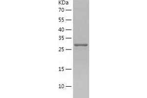 Western Blotting (WB) image for Heparan Sulfate (Glucosamine) 3-O-Sulfotransferase 1 (HS3ST1) (AA 21-307) protein (His tag) (ABIN7284305) (HS3ST1 Protein (AA 21-307) (His tag))