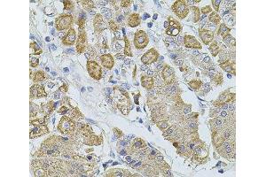 Immunohistochemistry of paraffin-embedded Human stomach using TRPA1 Polyclonal Antibody at dilution of 1:100 (40x lens). (TRPA1 抗体)