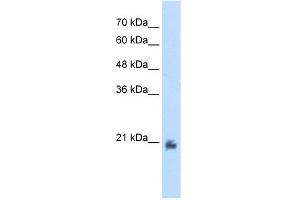 WB Suggested Anti-METTL7A Antibody Titration:  2.
