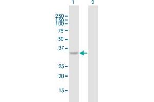 Western Blot analysis of C10orf46 expression in transfected 293T cell line by C10orf46 MaxPab polyclonal antibody. (CACUL1 抗体  (AA 1-303))
