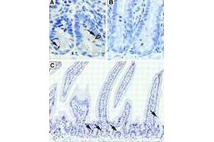 Immunohistochemistry (IHC) image for anti-Doublecortin-Like Kinase 1 (DCLK1) antibody (ABIN2895813) (DCLK1 抗体)