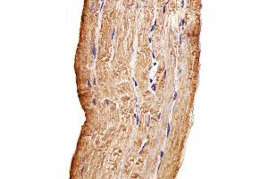 Immunohistochemical analysis of paraffin-embedded H. (MAP4K3 抗体)