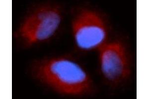 Immunofluorescence (IF) image for anti-Cyclin I (CCNI) (AA 1-377) antibody (PE) (ABIN5565347) (Cyclin I 抗体  (AA 1-377) (PE))