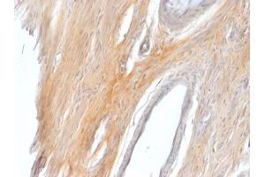 Formalin-fixed, paraffin-embedded Rat Uterus stained with Caldesmon Rabbit Polyclonal Antibody. (Caldesmon 抗体)