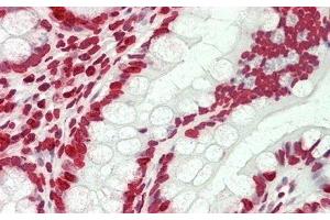 Detection of H3 in Human Small Intestine Tissue using Polyclonal Antibody to Histone H3 (H3) (Histone 3 抗体  (AA 1-136))