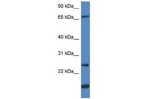 GSTM5 antibody used at 1 ug/ml to detect target protein. (GSTM5 抗体  (N-Term))