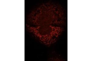 Human HepG2 cells fixed with 3. (IMMT 抗体  (AA 241-340))