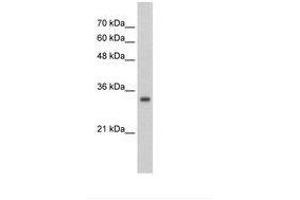 Image no. 1 for anti-Zinc Finger Protein 227 (ZNF227) (AA 301-350) antibody (ABIN203042) (ZNF227 抗体  (AA 301-350))