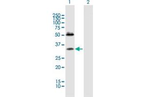 Western Blot analysis of SDC4 expression in transfected 293T cell line by SDC4 MaxPab polyclonal antibody. (SDC4 抗体  (AA 1-198))