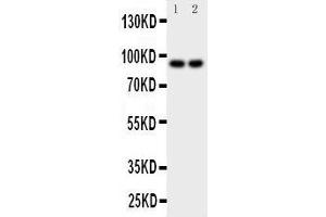Anti-MALT1 antibody, Western blotting Lane 1: MCF-7 Cell Lysate Lane 2: HELA Cell Lysate (MALT1 抗体  (C-Term))