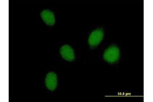 Immunofluorescence of purified MaxPab antibody to PHF16 on HeLa cell. (PHF16 抗体  (AA 1-823))