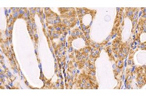 Immunohistochemistry (IHC) image for anti-Induced Myeloid Leukemia Cell Differentiation Protein Mcl-1 (MCL1) (AA 2-307) antibody (ABIN7440890)