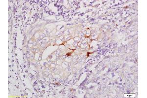Immunohistochemistry (IHC) image for anti-Catenin, beta (CATNB) (pSer33), (pSer37) antibody (ABIN683893)