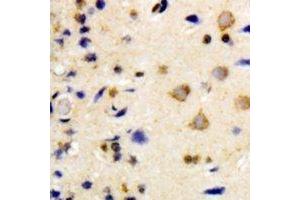 Immunohistochemical analysis of NEK7 staining in human brain formalin fixed paraffin embedded tissue section. (NEK7 抗体)