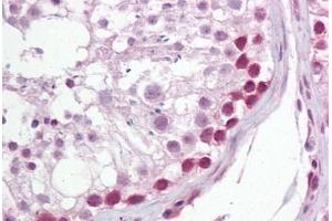 Anti-UNG antibody IHC staining of human testis. (UNG 抗体  (AA 281-298))
