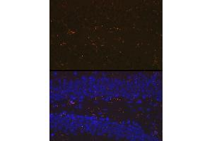 Immunofluorescence analysis of mouse brain using //IB Rabbit mAb (9776) at dilution of 1:100 (40x lens). (Iba1 抗体)