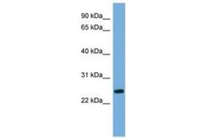 Image no. 1 for anti-Protein FAM164B (ZC2HC1B) (AA 35-84) antibody (ABIN6745661) (FAM164B 抗体  (AA 35-84))