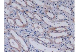 Immunohistochemistry (IHC) image for anti-Collagen, Type IV, alpha 3 (COL4A3) (AA 1428-1670) antibody (ABIN7434707)