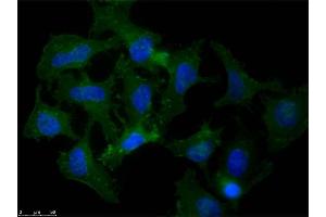 Immunofluorescence (IF) image for anti-Amyloid beta (Abeta) (N-Term) antibody (ABIN95037)