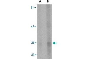 Western blot analysis of ENDOG expression in HepG2 cell lysate with ENDOG monoclonal antibody, clone 7F2D7  at (A) 5 and (B) 10 ug/mL .
