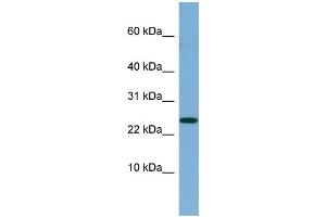 WB Suggested Anti-NBL1 Antibody Titration: 0. (NBL1 抗体  (Middle Region))