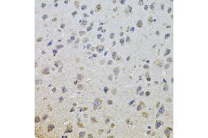 Immunohistochemistry of paraffin-embedded mouse brain using EGFR antibody (ABIN5997646) at dilution of 1/100 (40x lens). (EGFR 抗体)